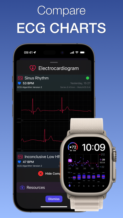 Heart Analyzer: Pulse Trackerのおすすめ画像4