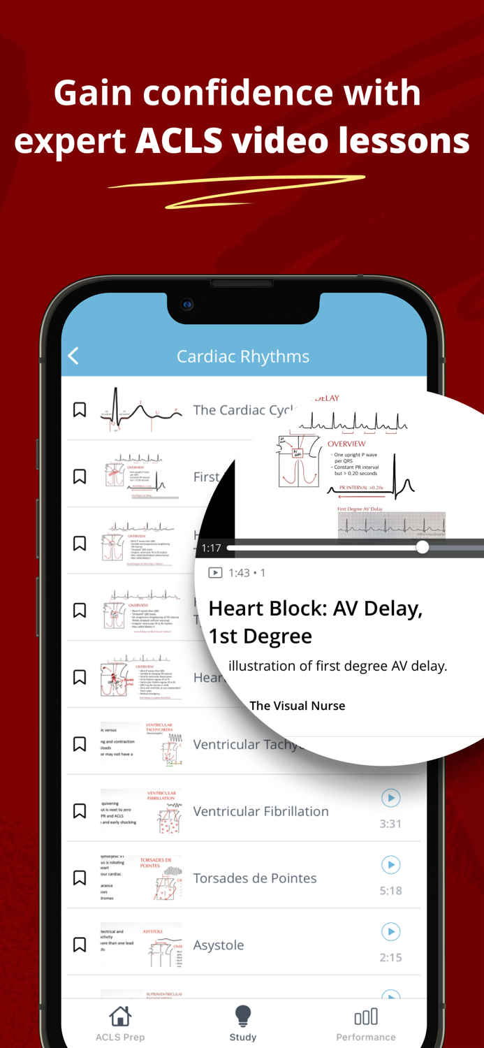 ACLS Mastery Practice