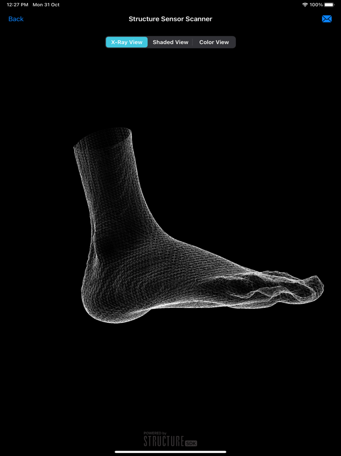 3DFootScan