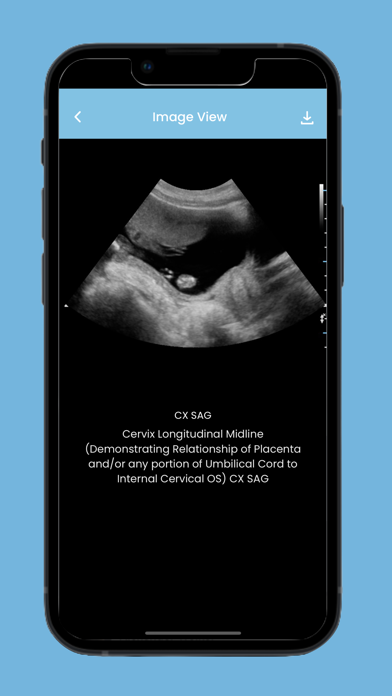 Ultrasound Protocol HandBook Screenshot