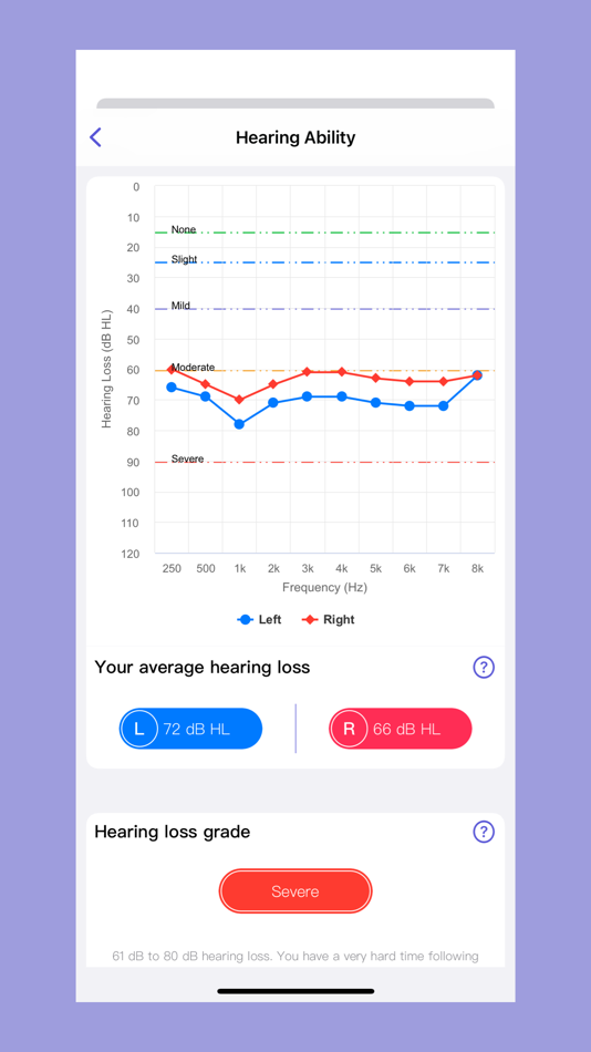 #5. xHearing (iOS) 由: Shenzhen Lanke Xuntong Technology Co., Ltd.
