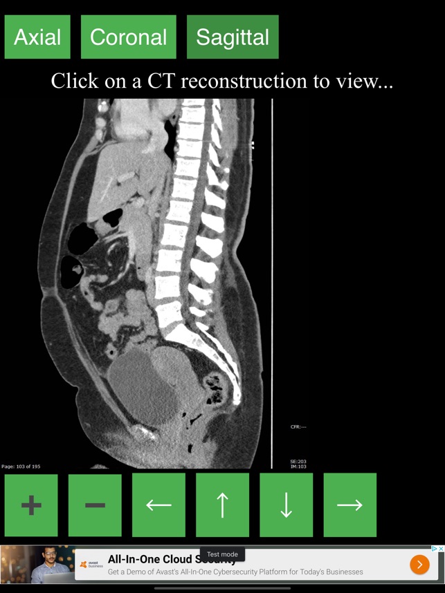 why ct scan abdomen pelvis