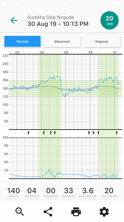 Fetosense Remote screenshot-5