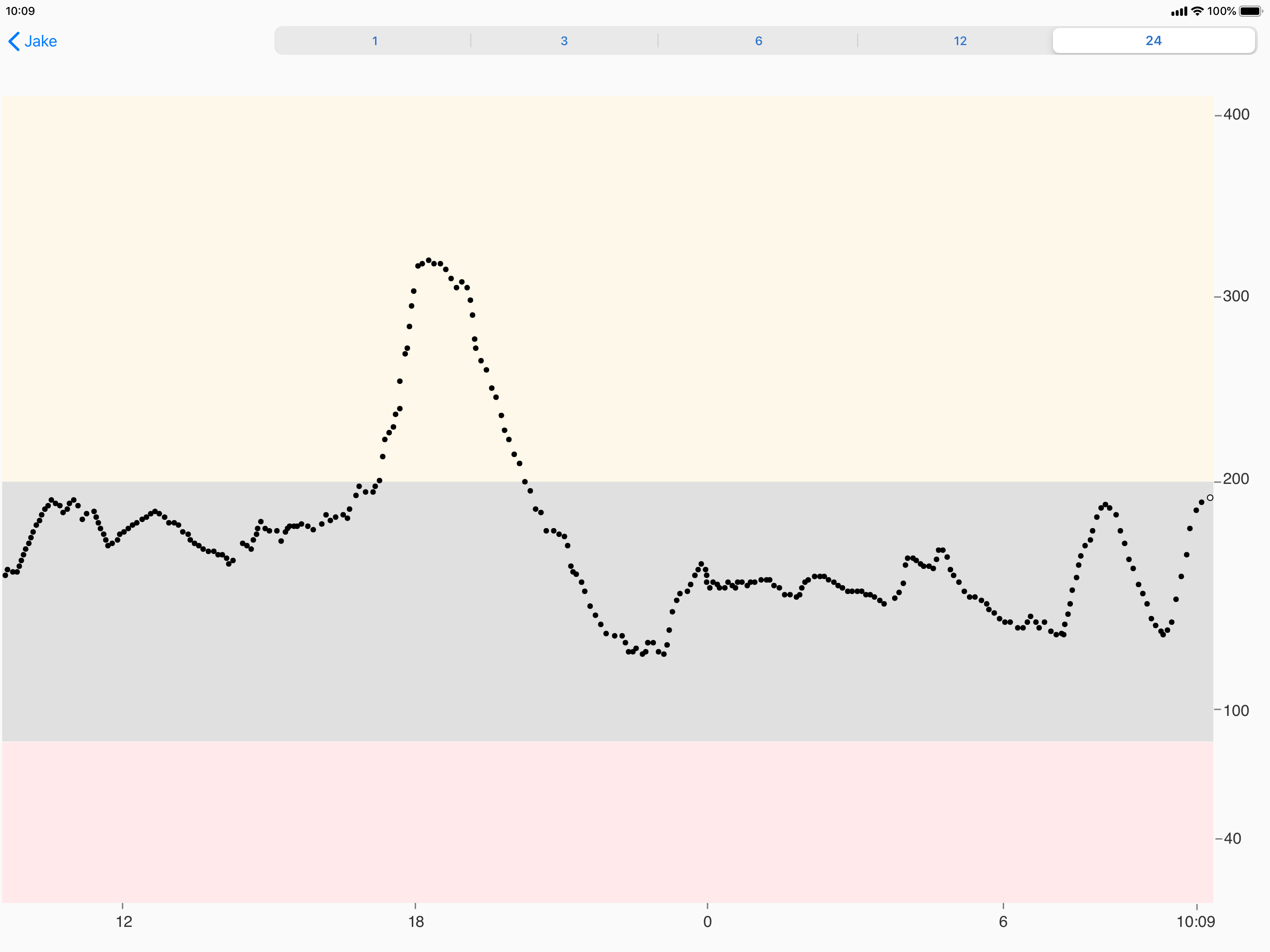 Dexcom Follow mg/dL DXCM3
