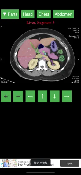 Game screenshot Anatomy on Radiology CT mod apk