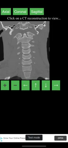 Game screenshot CT Cervical Spine hack