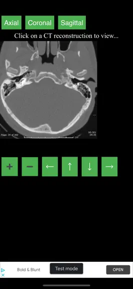 Game screenshot CT Cervical Spine mod apk