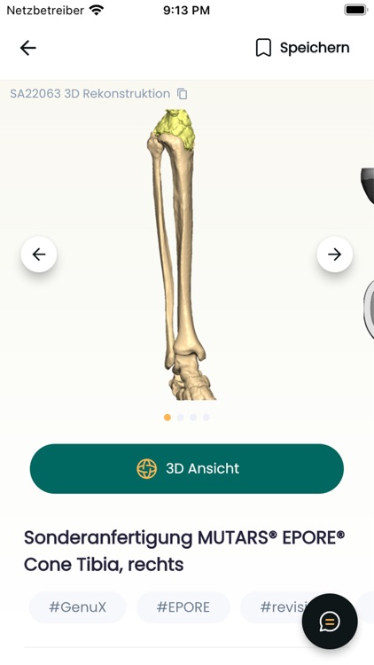 implantcast C-Fit 3D®