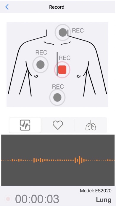 Smart Stethoscope Screenshot