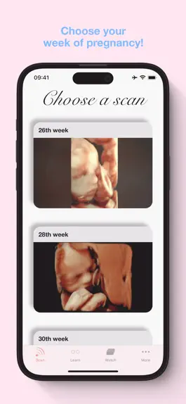 Game screenshot ScanBaby learn baby ultrasound apk