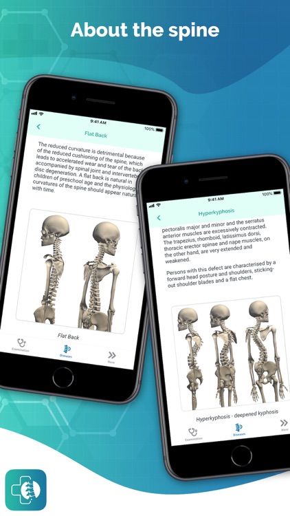 Healthy Back Posture Analysis screenshot-5