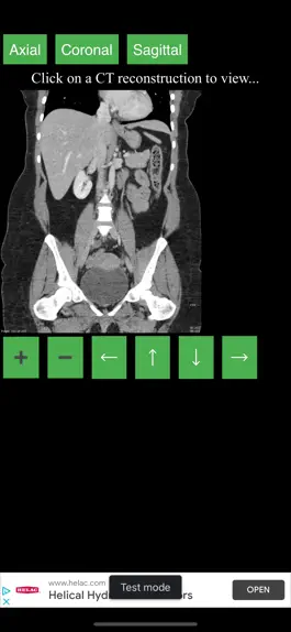 Game screenshot CT Abdomen Pelvis apk