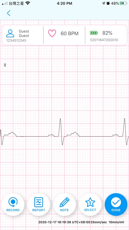 QT ECG