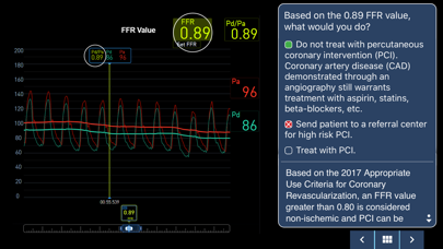 IVUS + Physiology Pro Screenshot