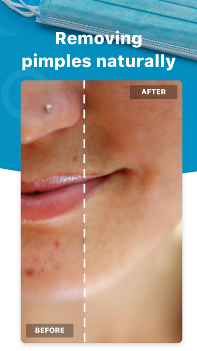 Blemish Editor - Face Tuner Screenshot