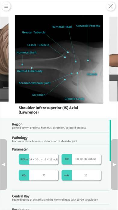Navi Radiography Pro Screenshot