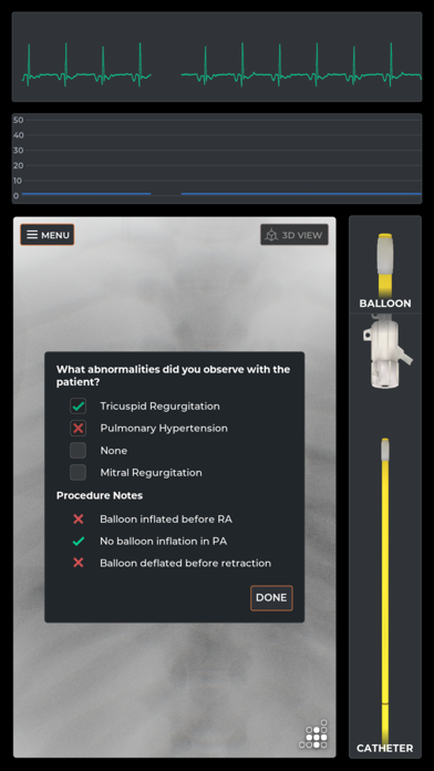 Mentice Right Heart Cath screenshot 4