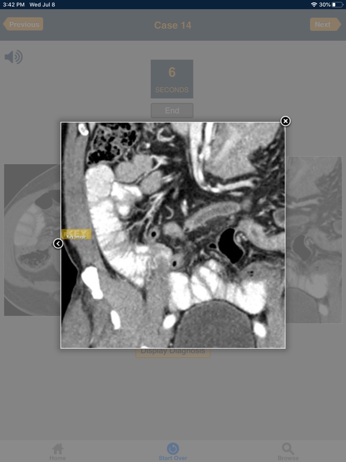 CTisus 10 Minute ER Challenge