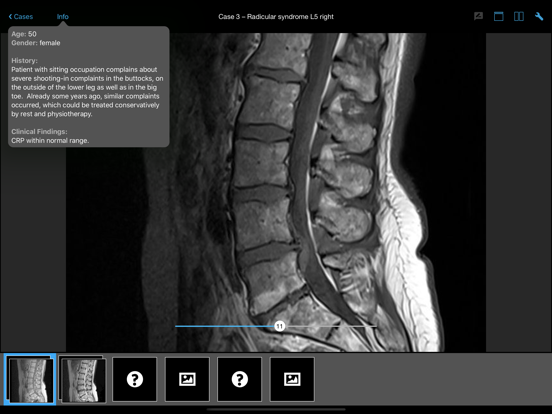 Screenshot #4 pour BerlinCaseViewer: Imaging
