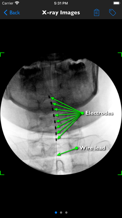 iSpinePainManagement Screenshot