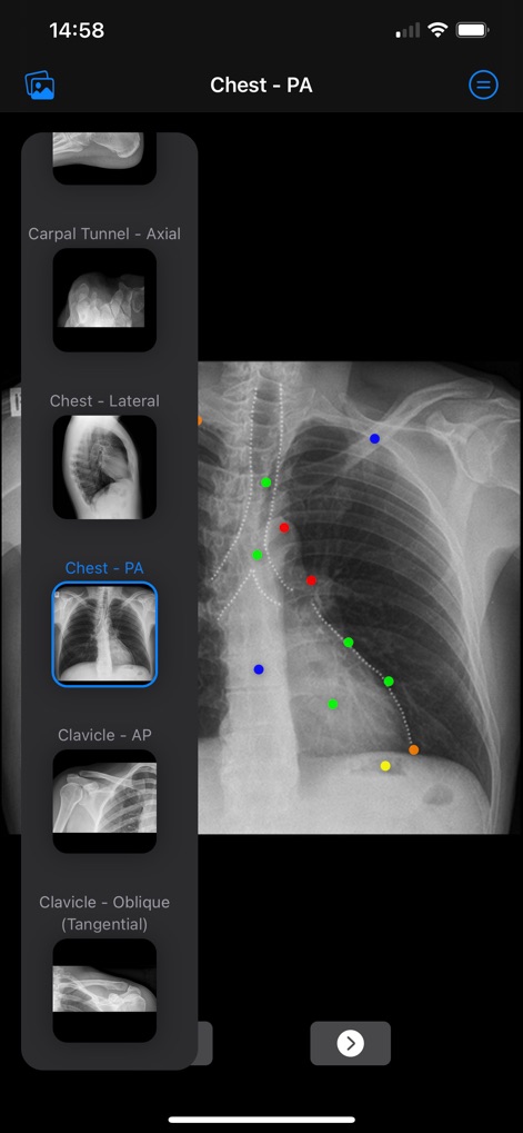 Xray Anatomy - Explore the app's comprehensive view selection, showcasing a variety of radiographic projections from different body regions and specific anatomy, such as the selected 'Chest - PA' view.