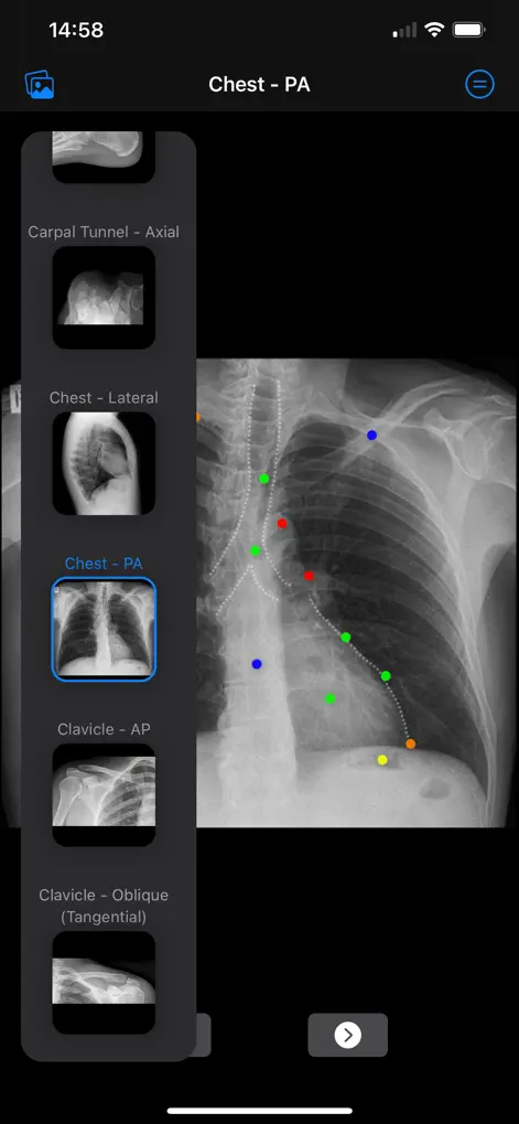 Xray Anatomy - Medical App | MWM