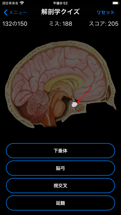 解剖学クイズのおすすめ画像2