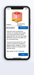 BCG Pressure Ulcer Guide screenshot #4 for iPhone