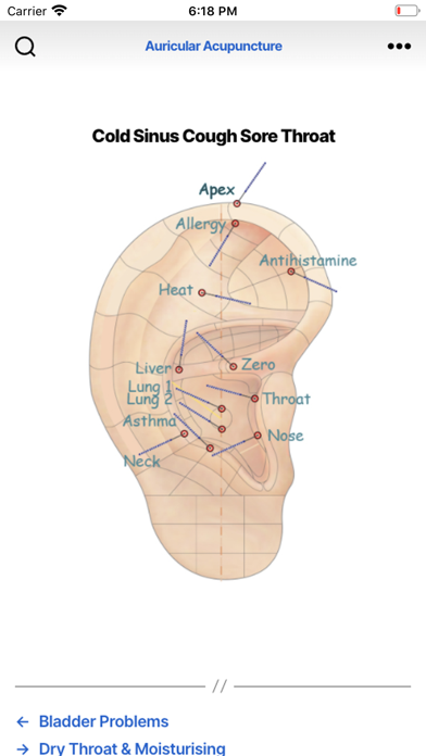Auricular Acupuncture Screenshot