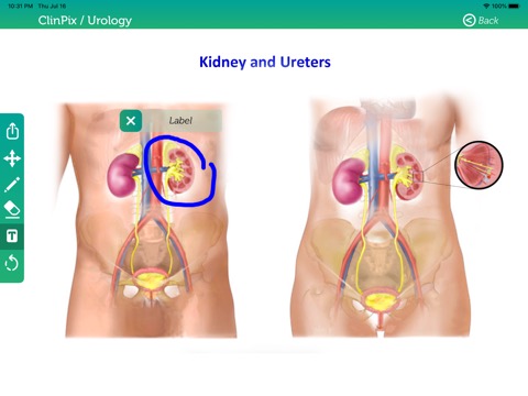 ClinPix: Urologyのおすすめ画像2