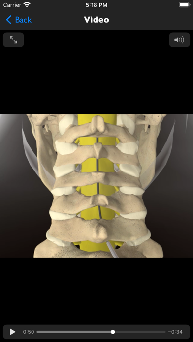 iSpinePainManagement Screenshot