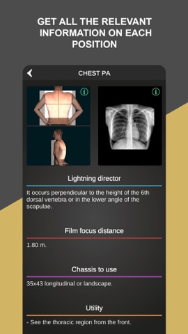 RX - Radiographic Positioningのおすすめ画像5