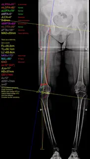 osteotomyapp problems & solutions and troubleshooting guide - 4