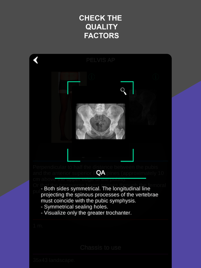 RX - Radiographic Positioning