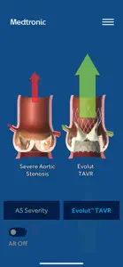 AS TAVR Education screenshot #4 for iPhone