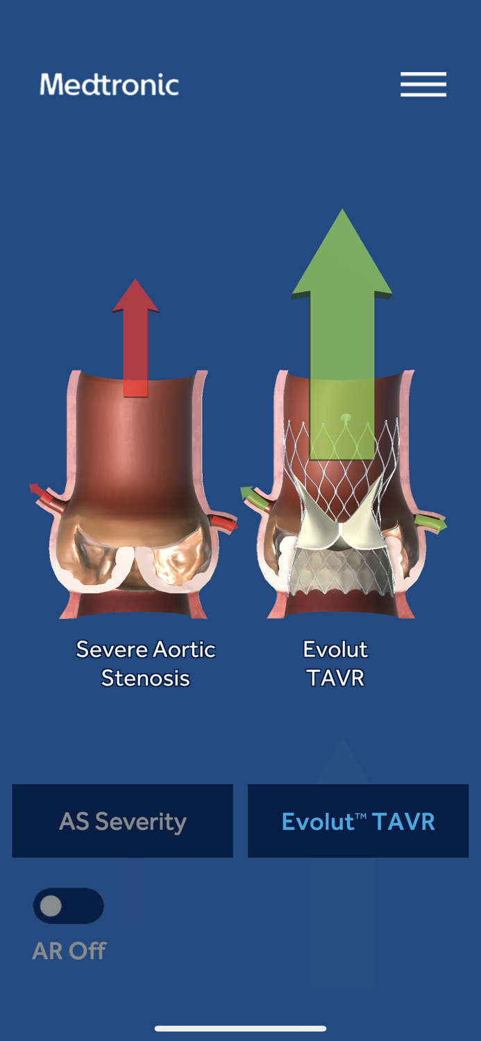 AS TAVR Education