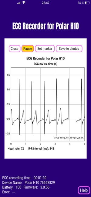 ECG EKG Recorder for Polar H10 on the App Store