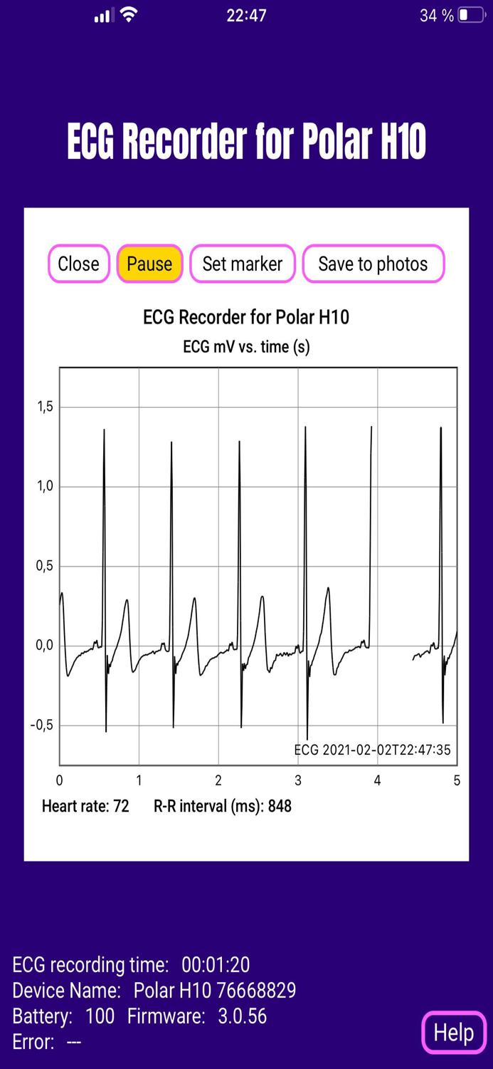 ECG EKG Recorder for Polar H10