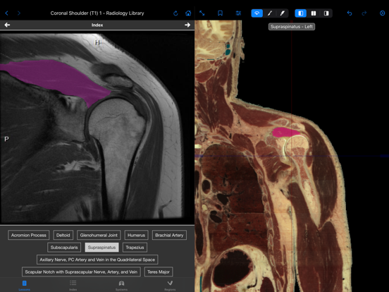 VH Dissector Pro iPad screenshot 7 - Medical app