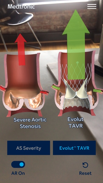 AS TAVR Education