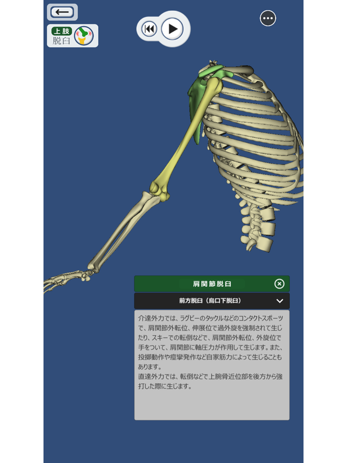 ３Dで分かる骨折と脱臼