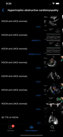 Game screenshot CARDIO3®Echocardiography apk