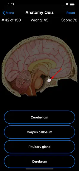 Game screenshot Anatomy Quiz hack