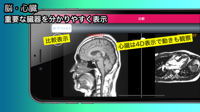 MedalVision Personal Med Image Screenshot