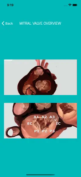 Game screenshot Mitral View hack