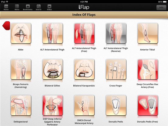 iFlap: Reconstructive Flaps iPad app afbeelding 4