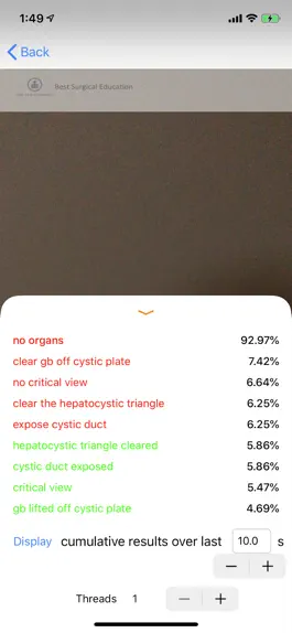Game screenshot Cholecystectomy AI hack