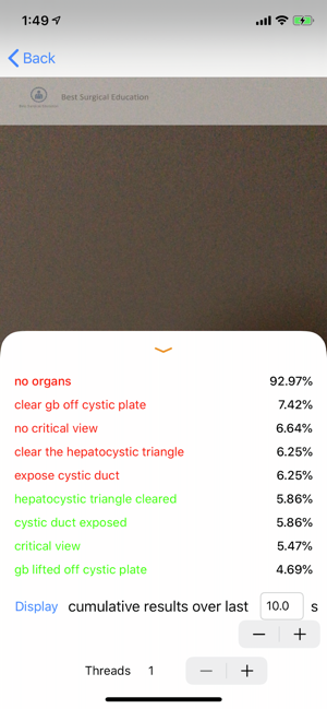 Cholecystectomy AI(圖3)-速報App