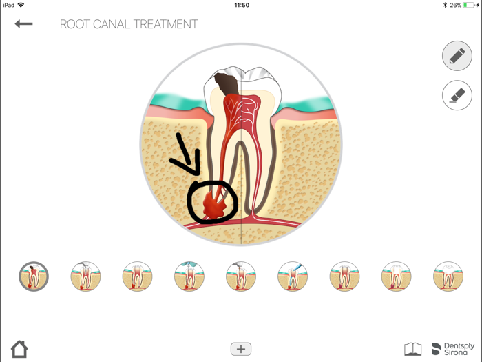 Dentsply Endo IQ® App