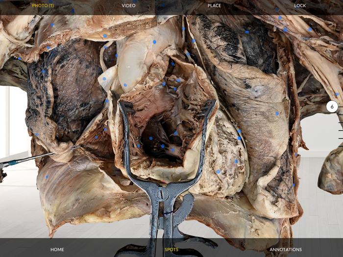 Dissection Master XR